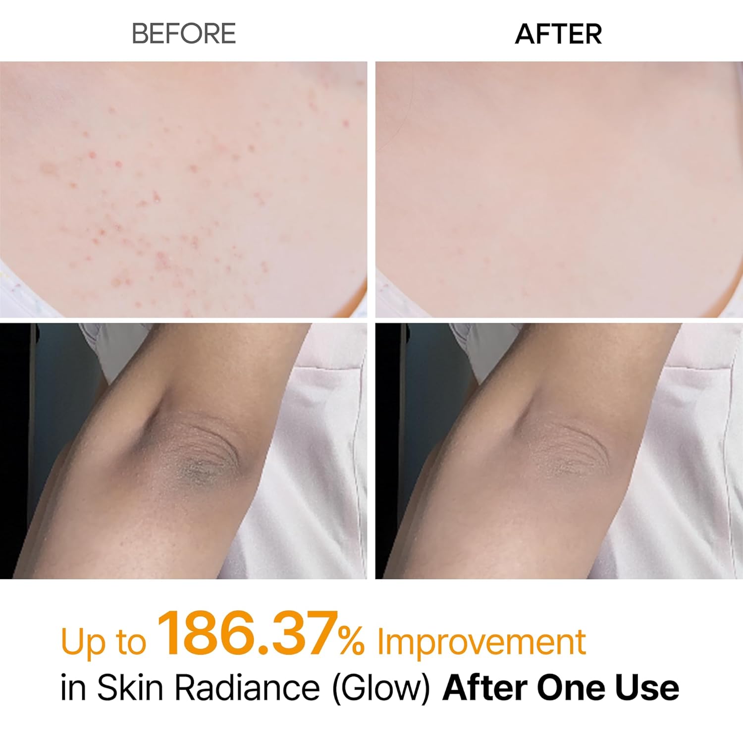 Dr Melaxin Exfoliating Kojic Acid Turmeric Spray