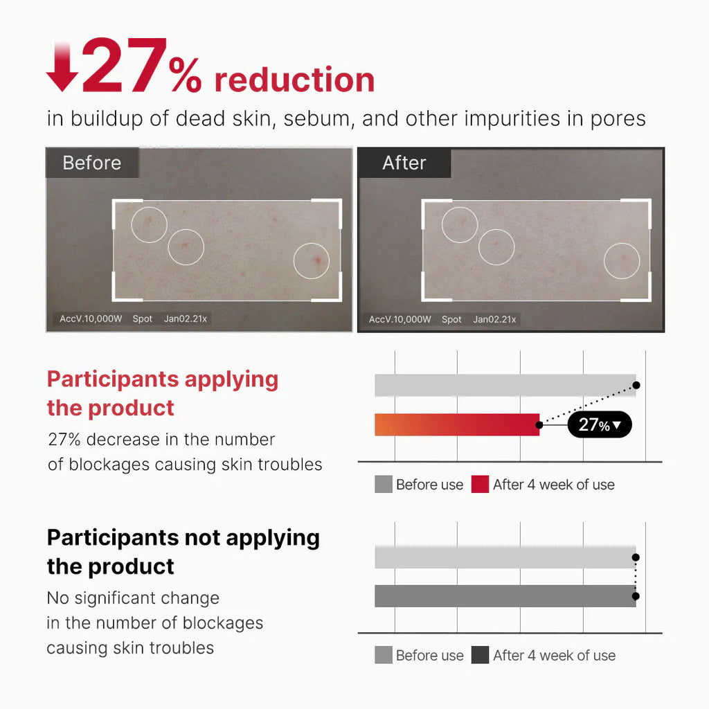 Medicube Red Acne Body Peeling Shot