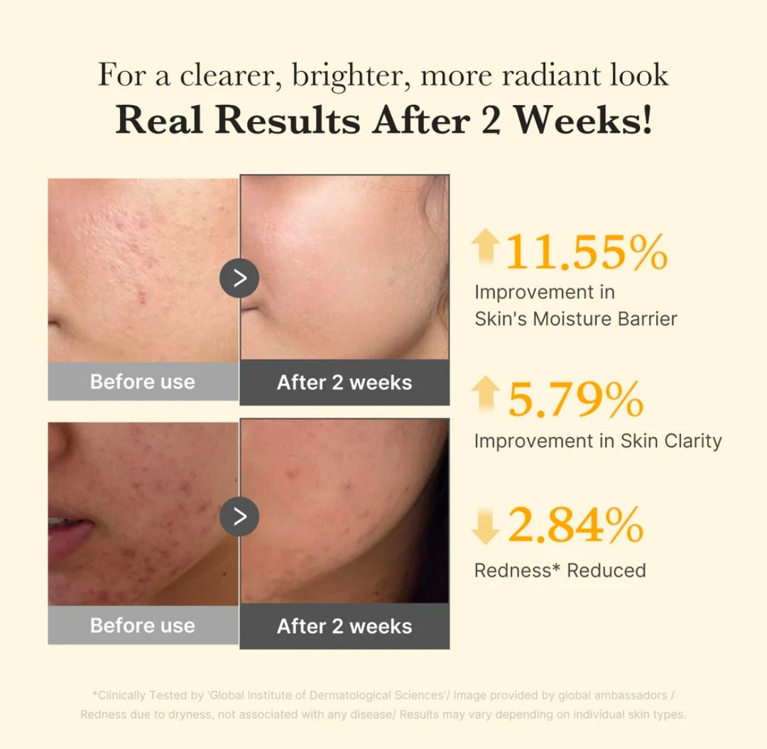 Medicube Kojic Acid Turmeric Niacinamide Serum
