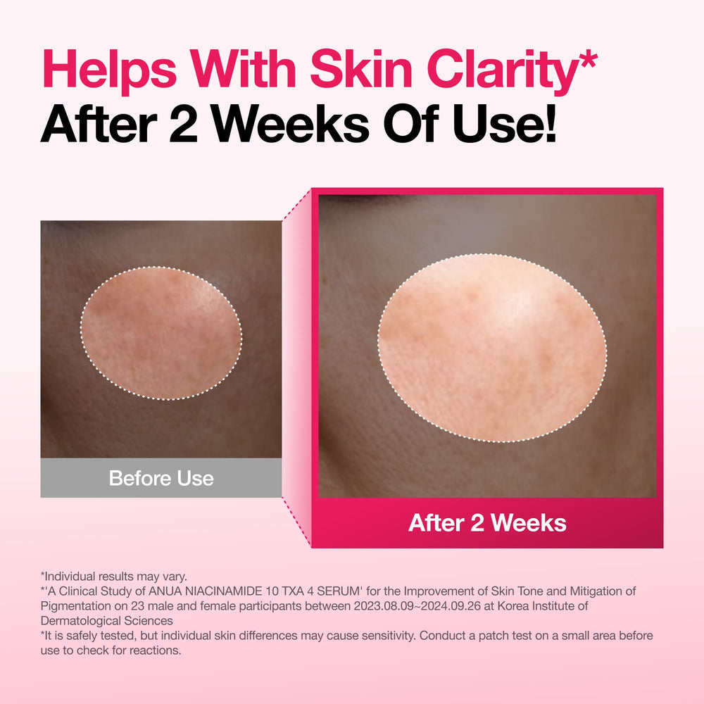 Anua Niacinamide 10 + TXA Serum
