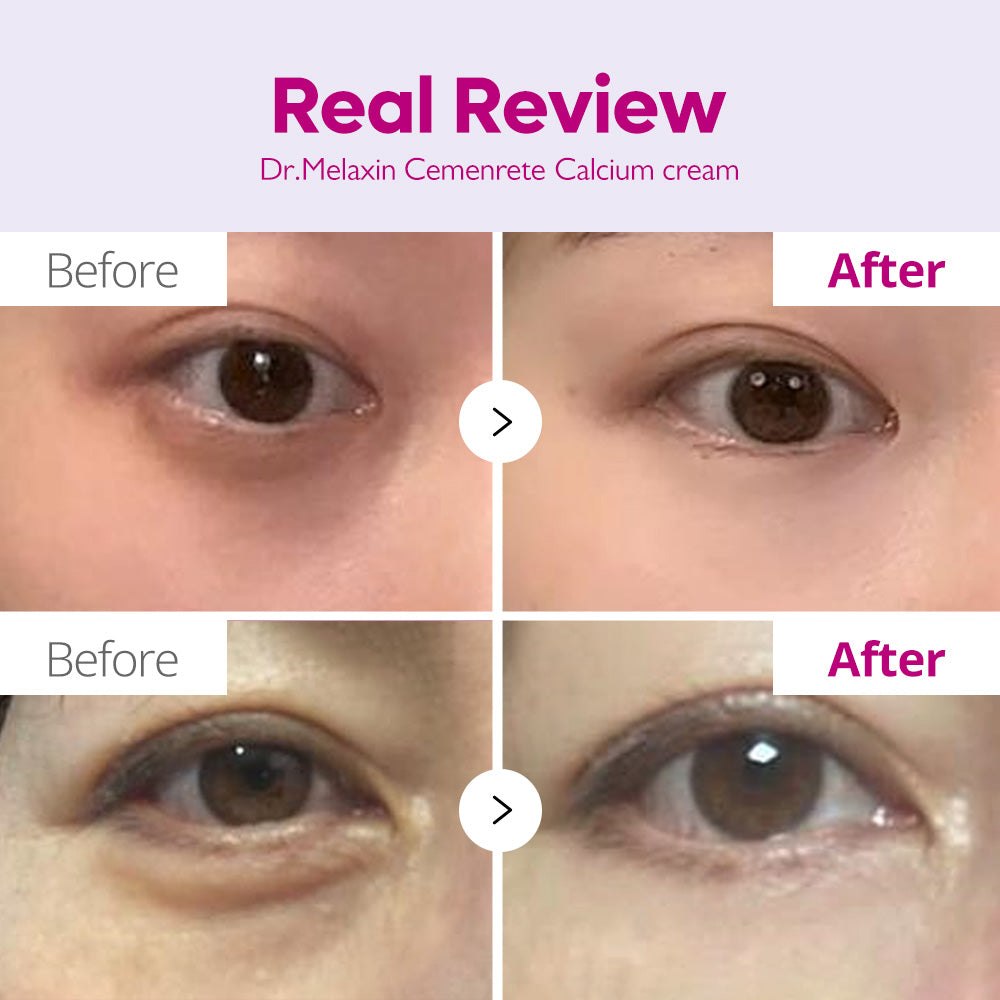 Dr Melaxin Calcium Dark Spot Cocer Eye Cream