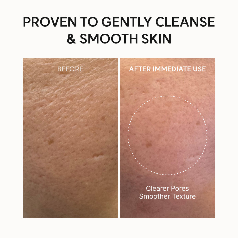Arencia Fresh Roseship Rice Moshi Cleanser