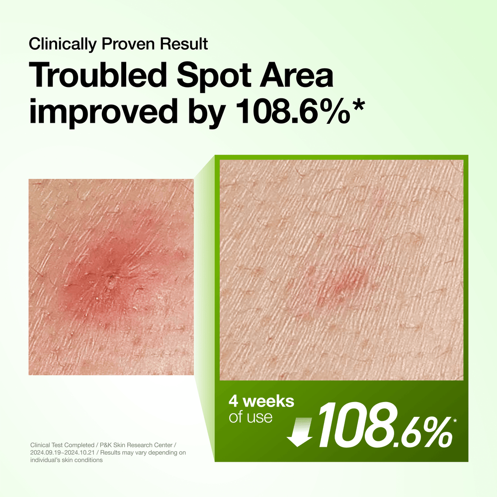 Anua Azelaic Acid 10 Hyaluron Redness Soothing Serum