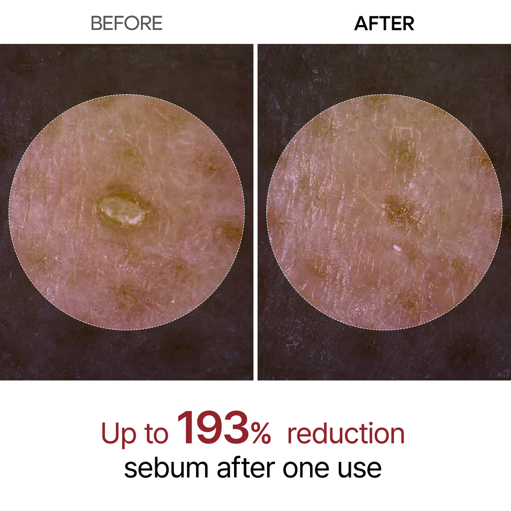 Dr Melaxin Exfoliating White Rice Ampoule