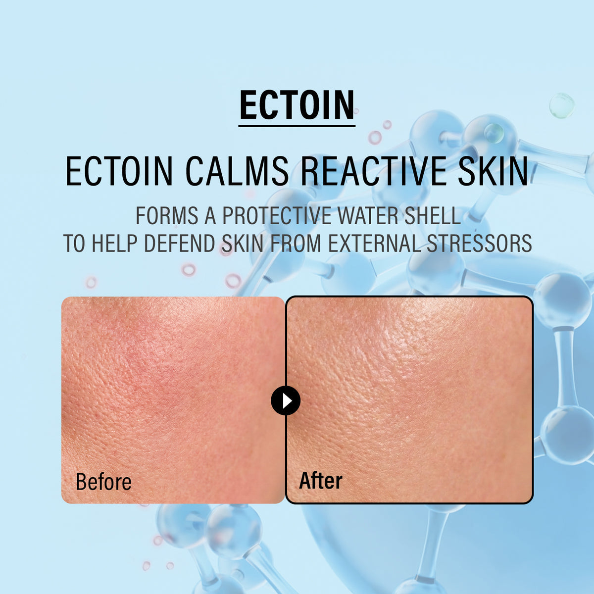 Epii Double Up Cream Ectoin & Panthenol