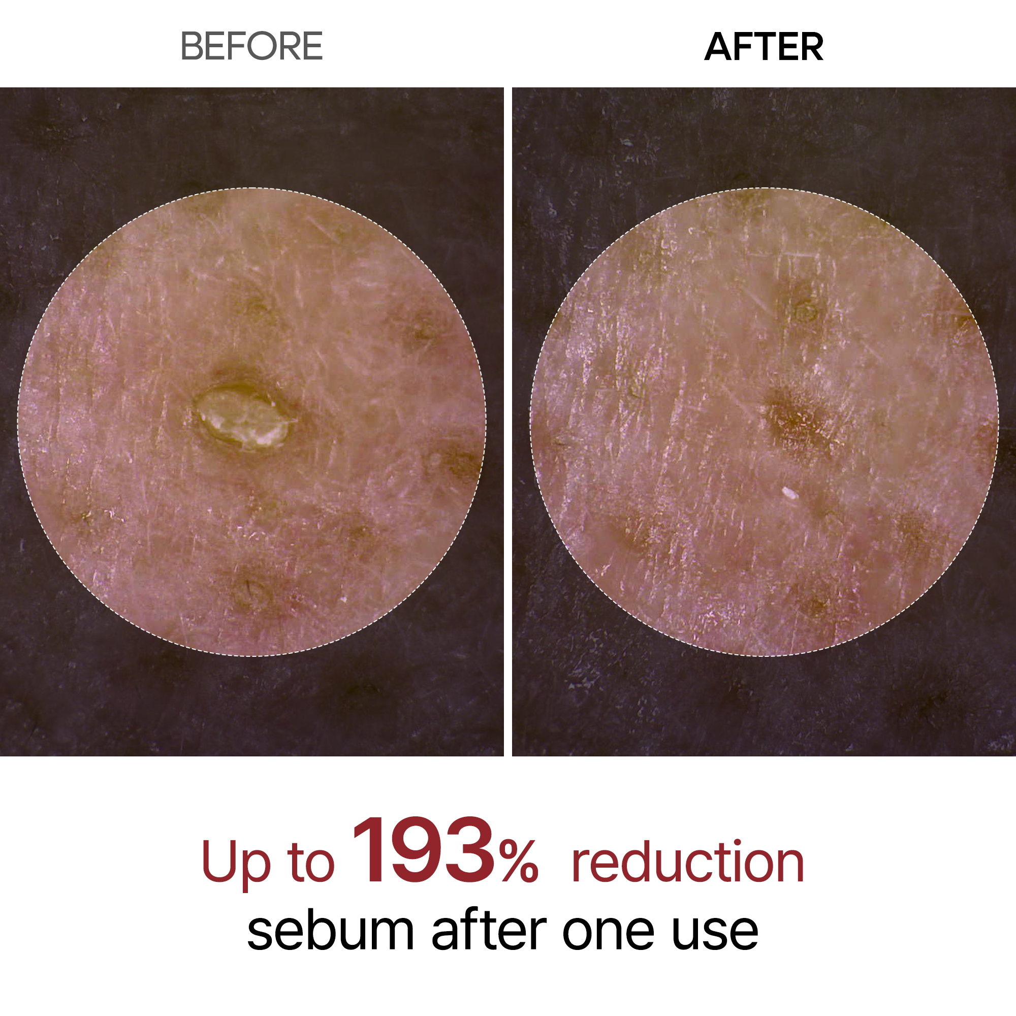 Dr Melaxin Exfoliating Black Rice Ampoule